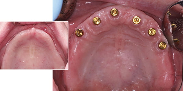 600x300_Tedders